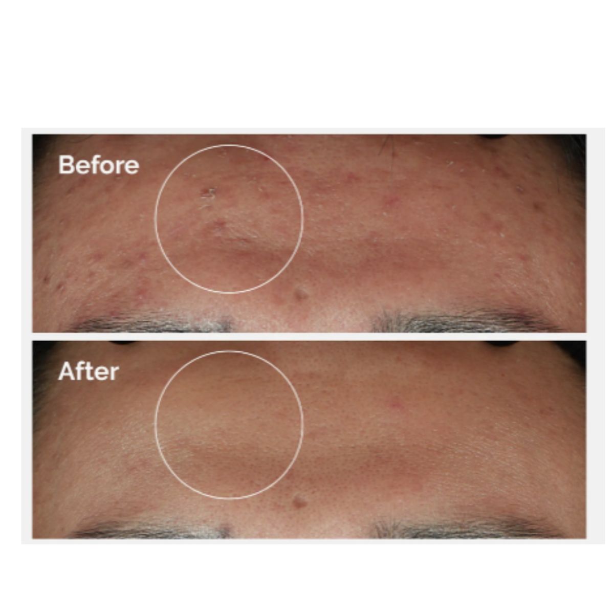 THE ORDINARY - The Ordinary Niacinamide 10% + Zinc 1% 30 ml Original