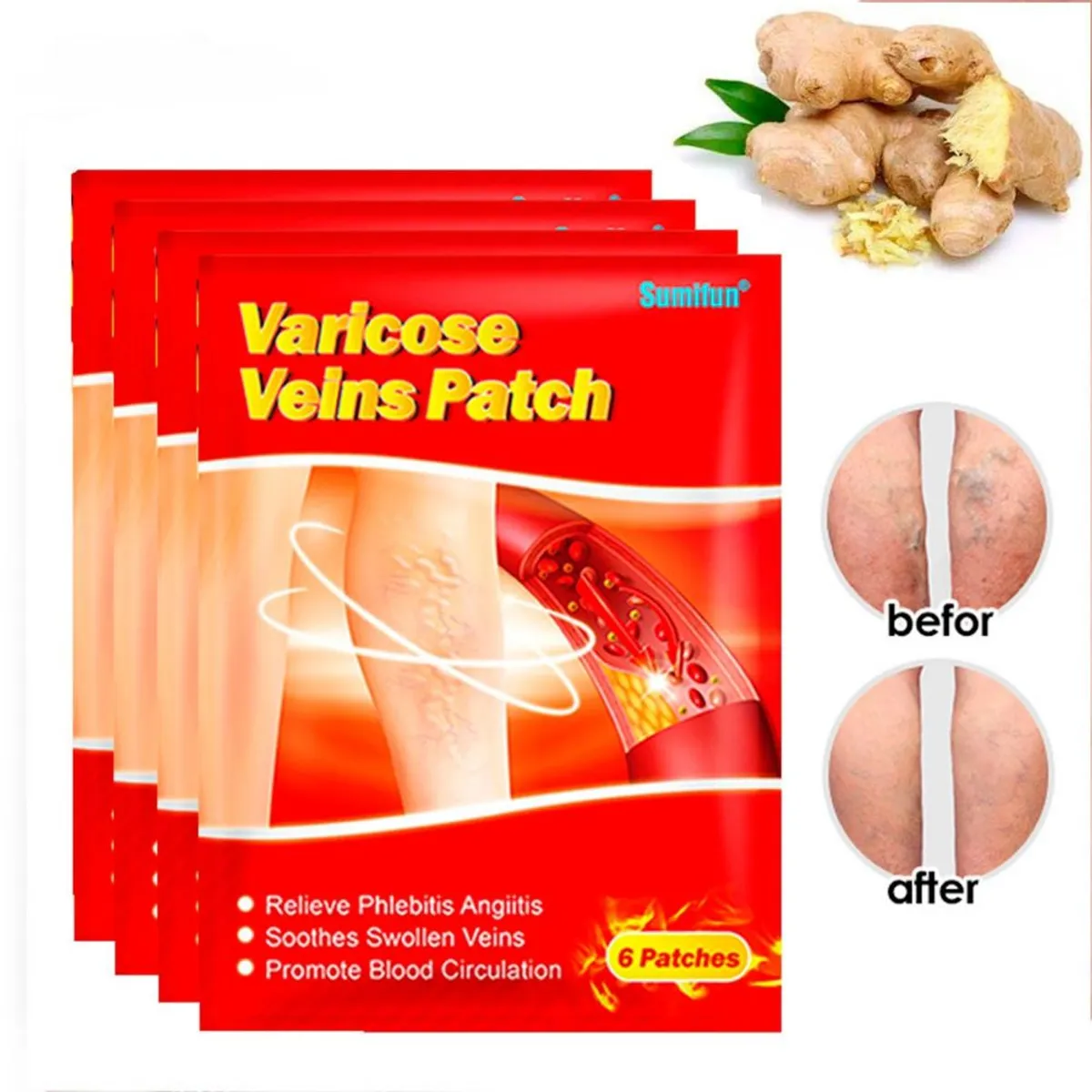 GENERICO - 6 Parches para Varices Elimina las Venas Hinchadas