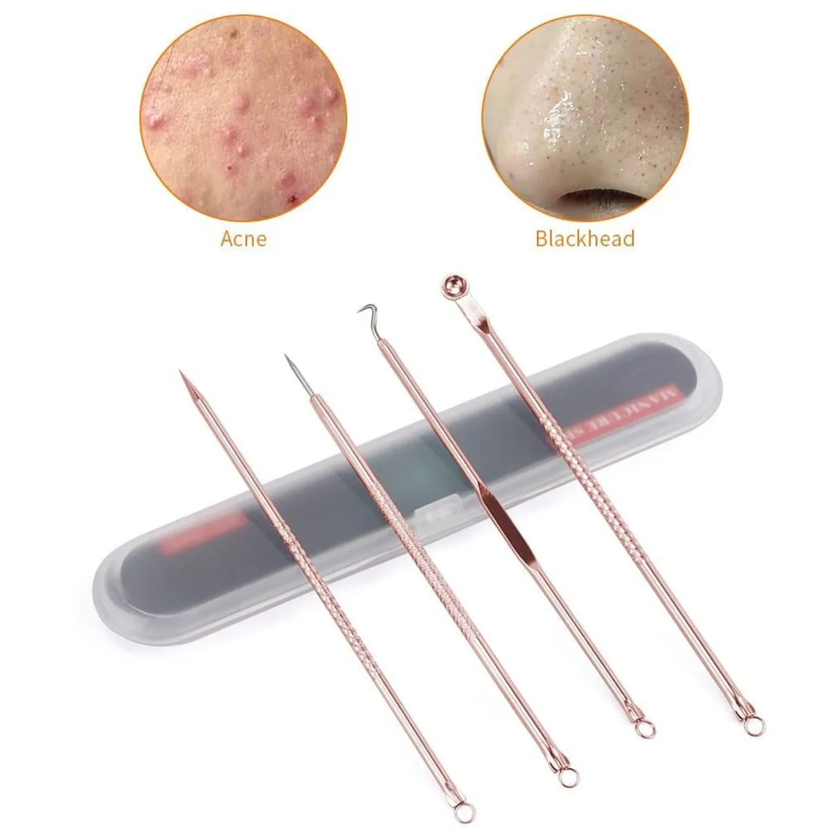 OEM - 2Kit de Espinillas Acné Pack para Limpieza de Barritos Puntos Negros