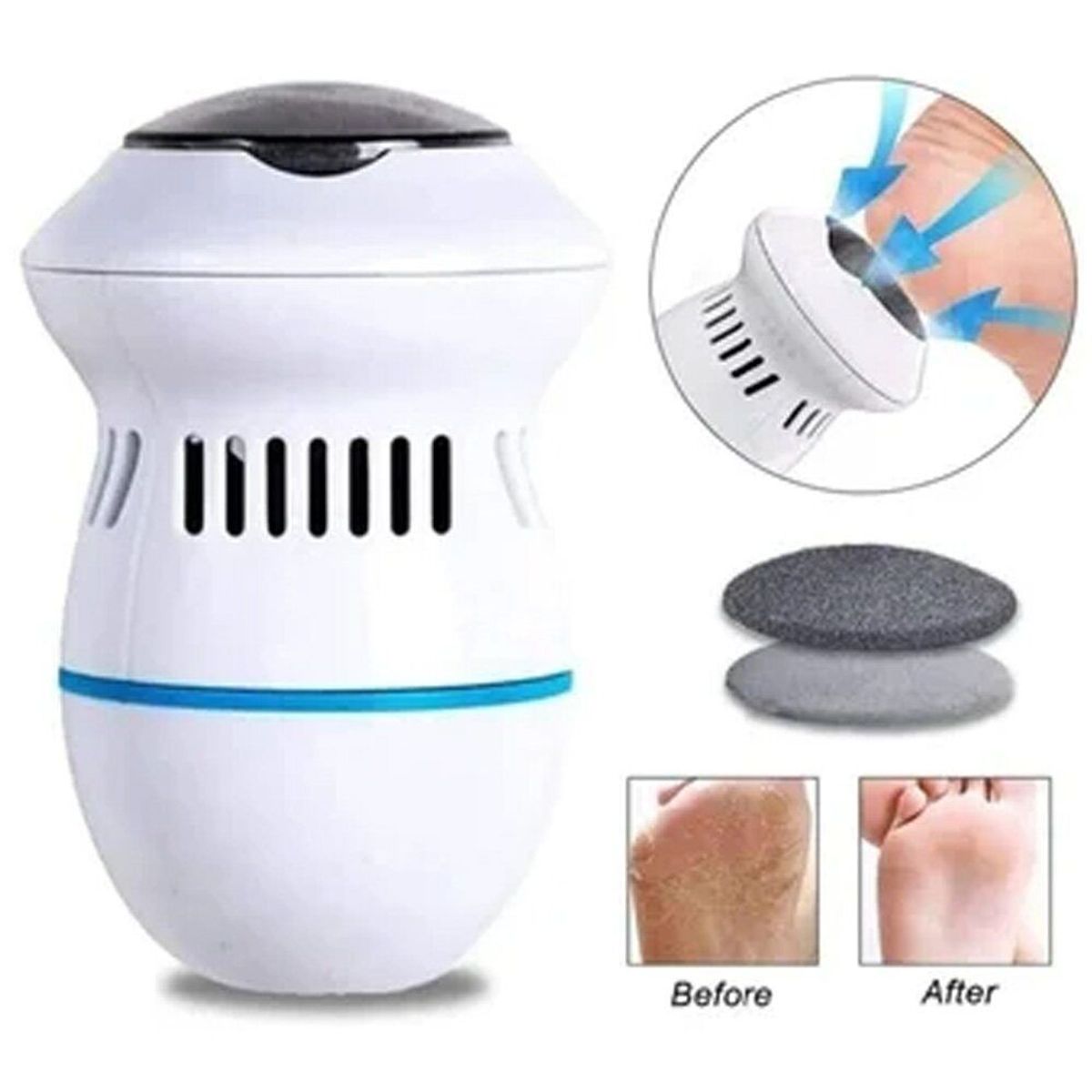 GENERICO - Removedor de Callos Recargable