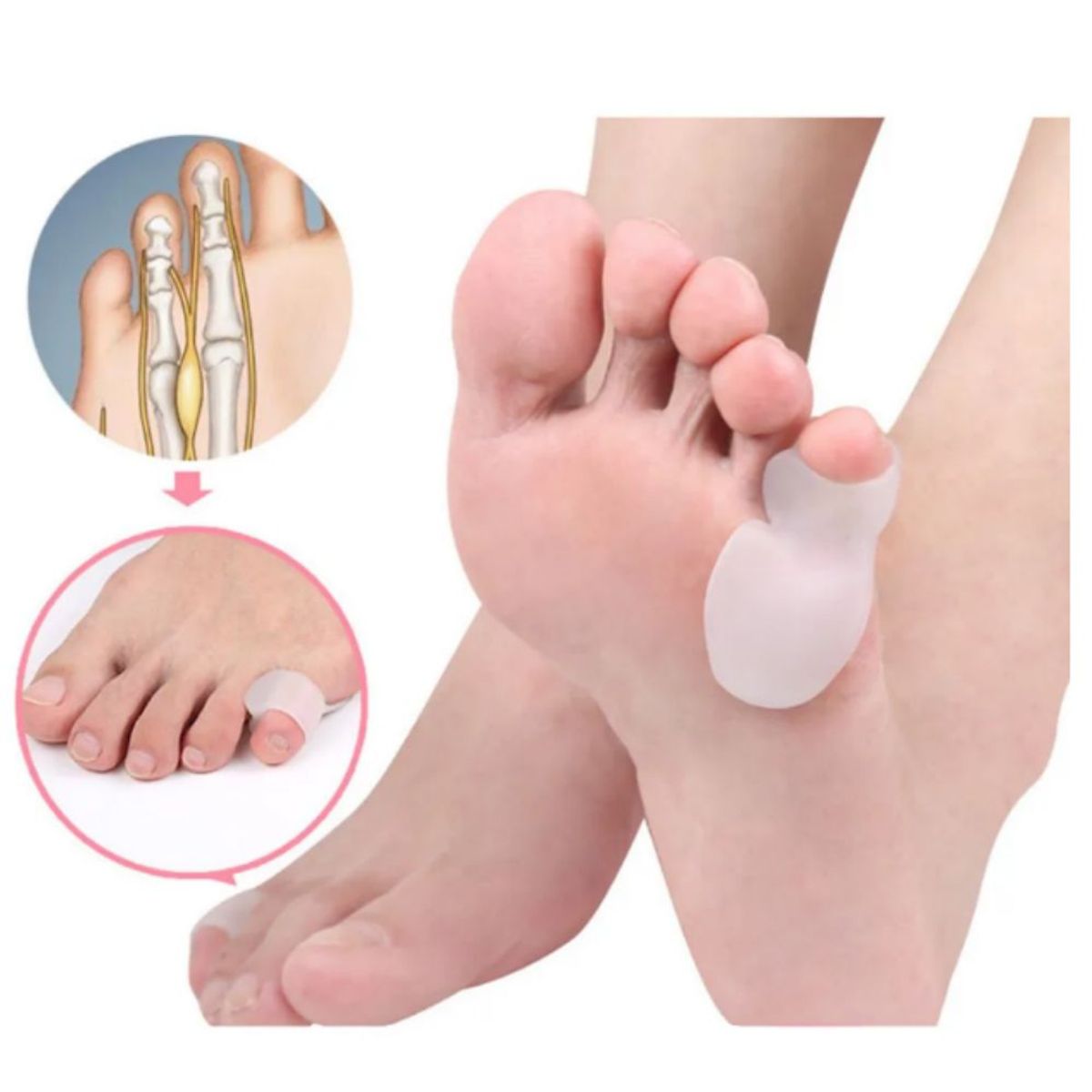 GENERICO - Corrector Separador de Dedo Pequeño Pie Férula para Juanete