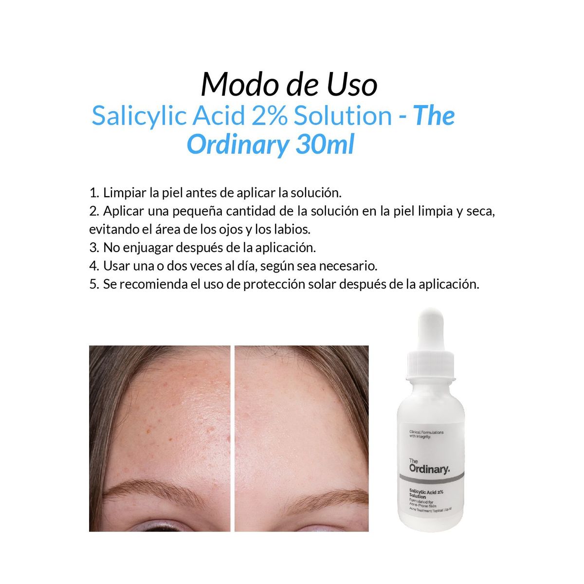 THE ORDINARY - 2 Salicylic Acid 2 Solution - The Ordinary 30ml