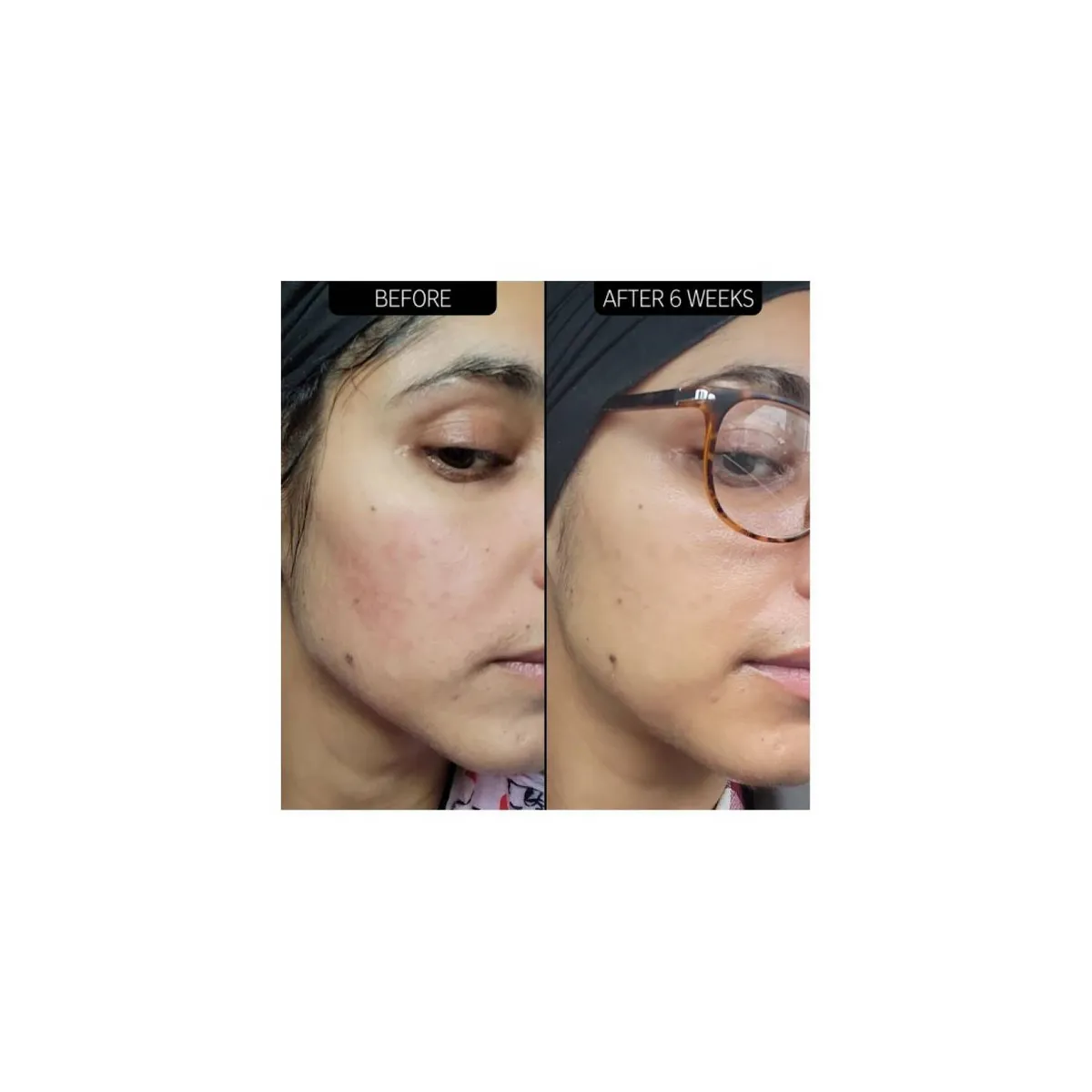 THE INKEY LIST - Serum 10% 30ml The Inkey List