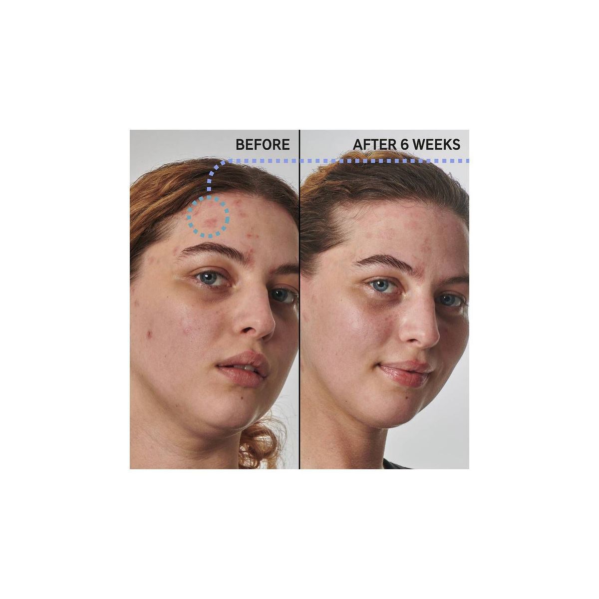 THE INKEY LIST - Crema Facial Humectante con 10% de Urea 50ml  - The INKEY List