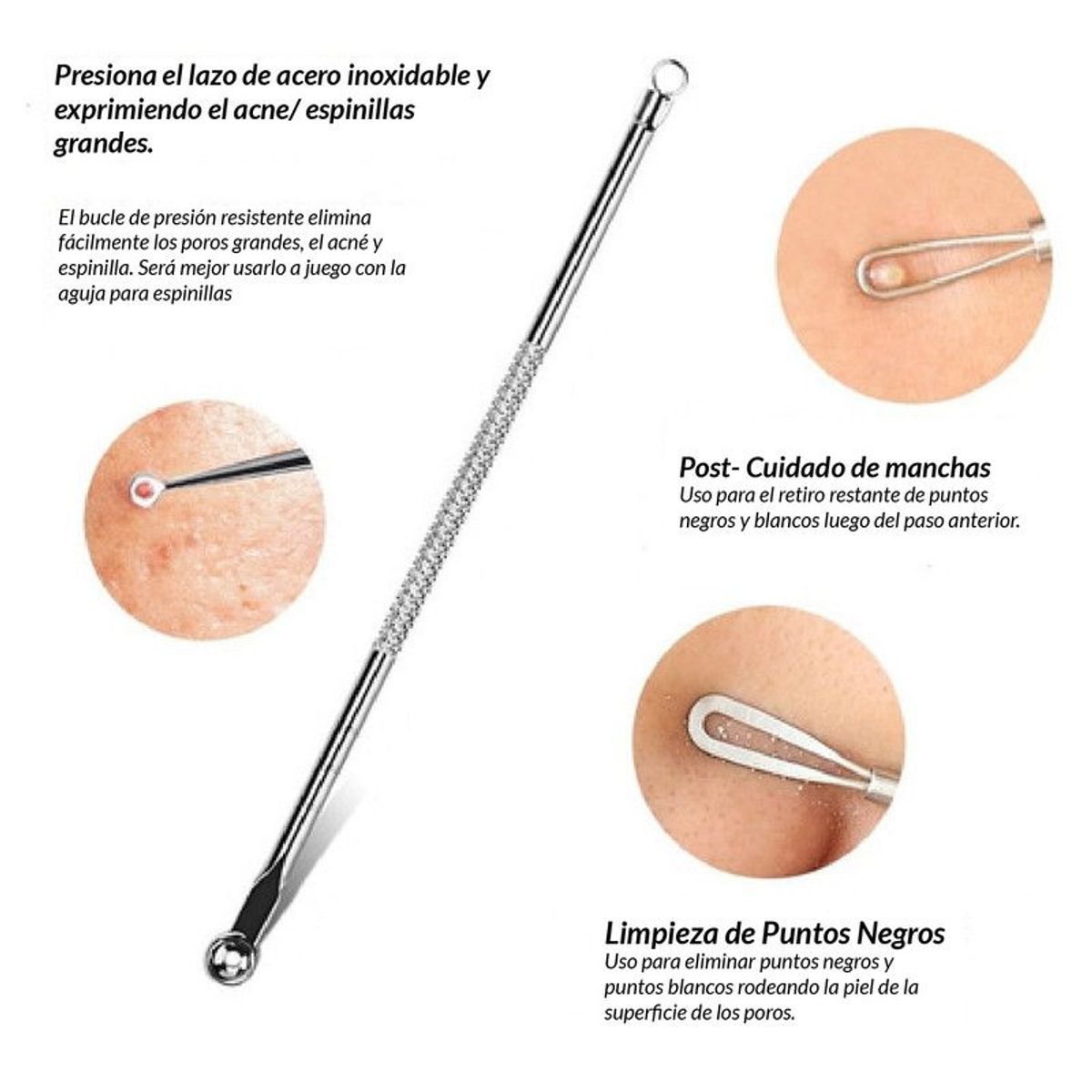 GENERICO - Kit Removedor De Espinillas Puntos Negros Granos (4 Piezas)