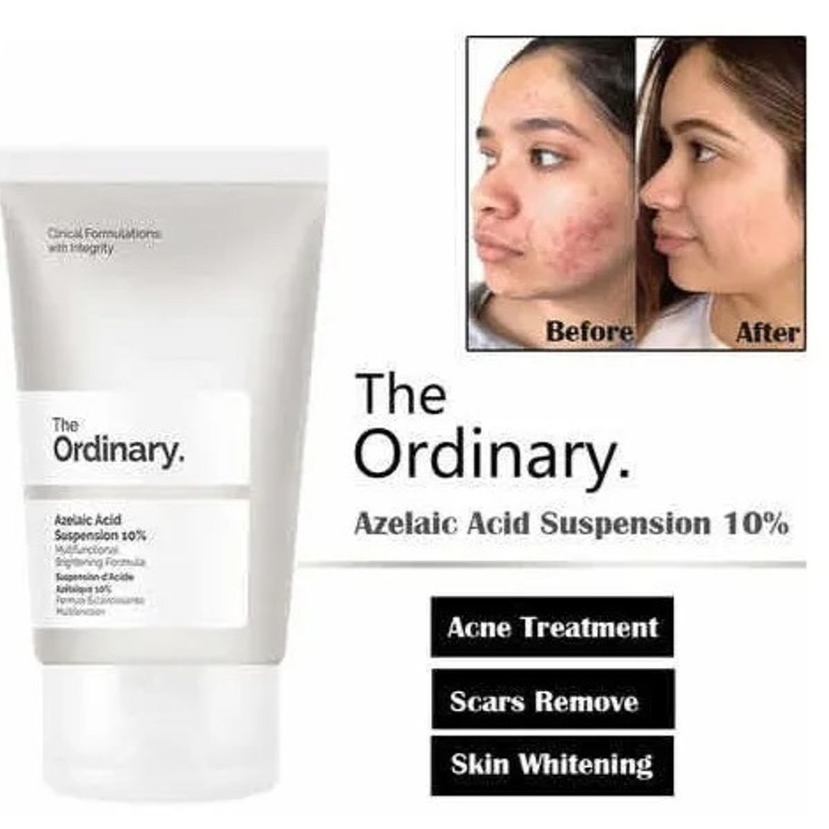 THE ORDINARY - The Ordinary Azelaic Acid Suspension 10% 30mL