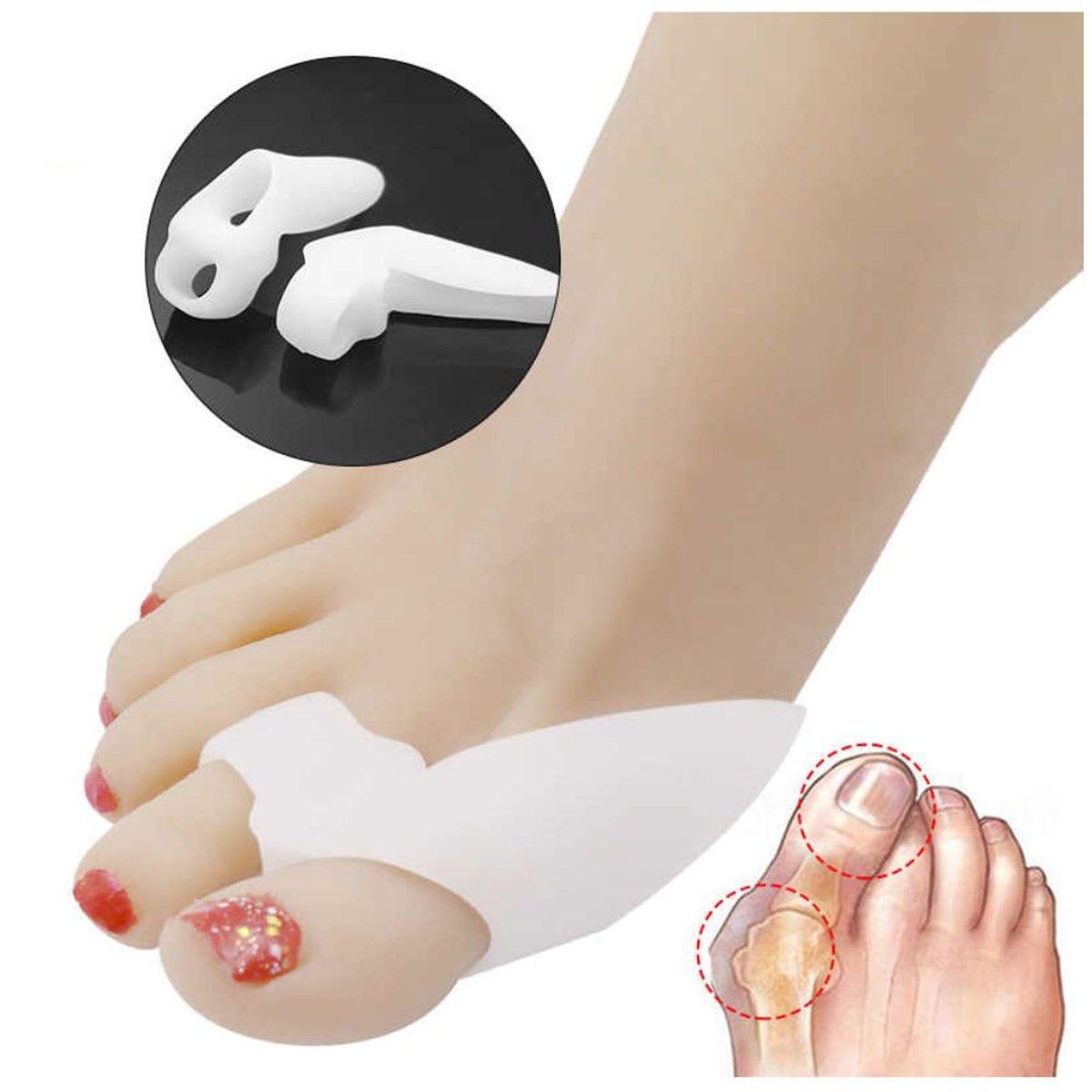 GENERICO - Corrector De Juanete Protector de Juanete del Pie 1 Par