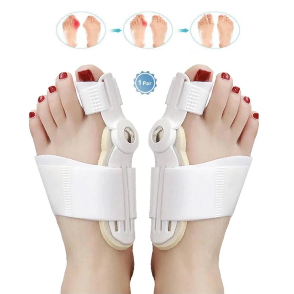 GENERICO - Corrector De Juanete 1 par Férula Endereza y Alivia el Pie