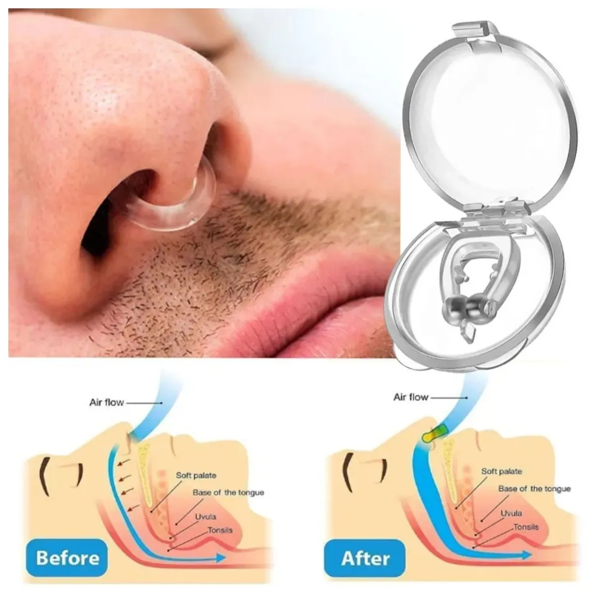 OEM - Clip nasal Antirronquidos para dejar de Roncar