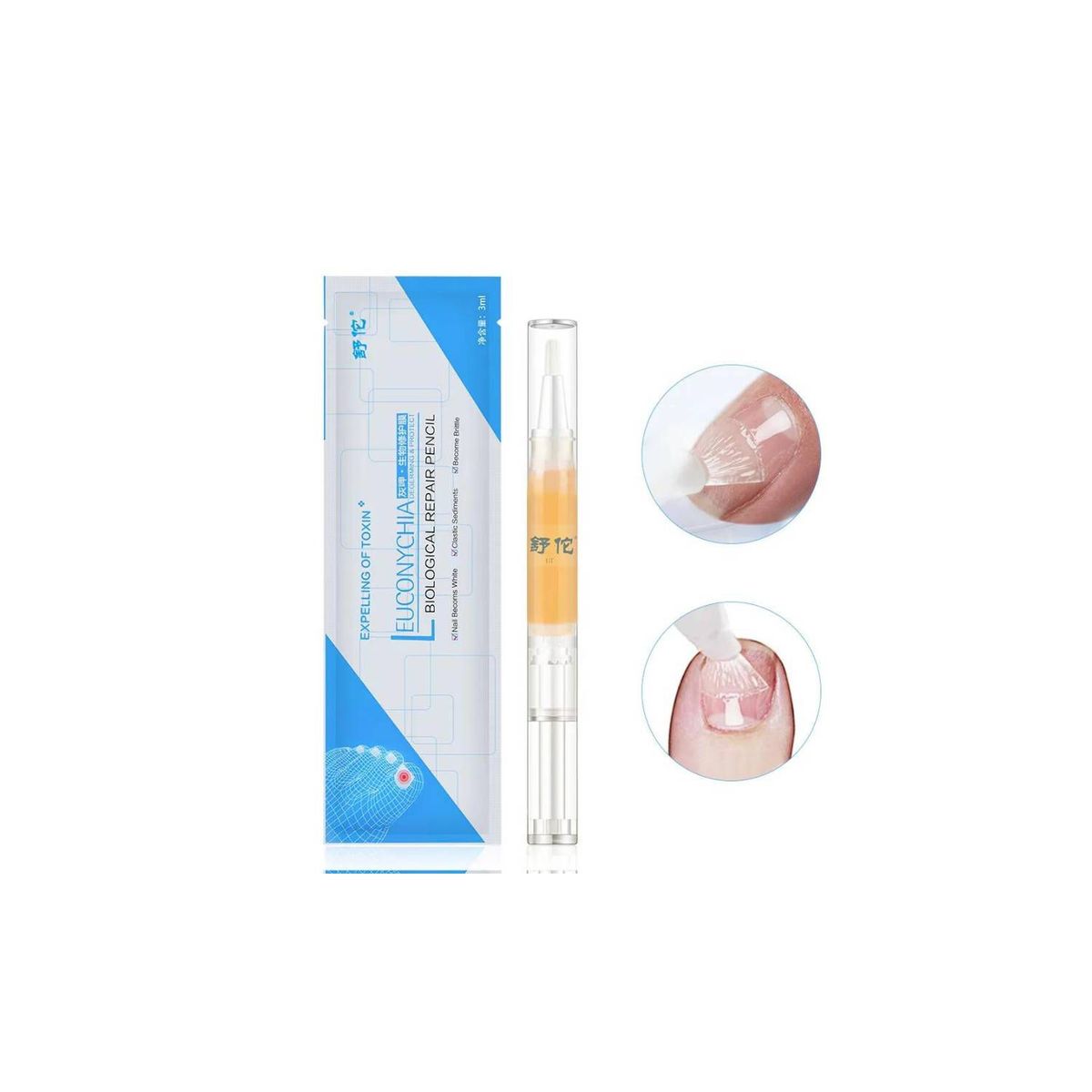 GENERICO - Lápiz Reparador de Uñas de los Pies y Manos - LEUCONYCHIA