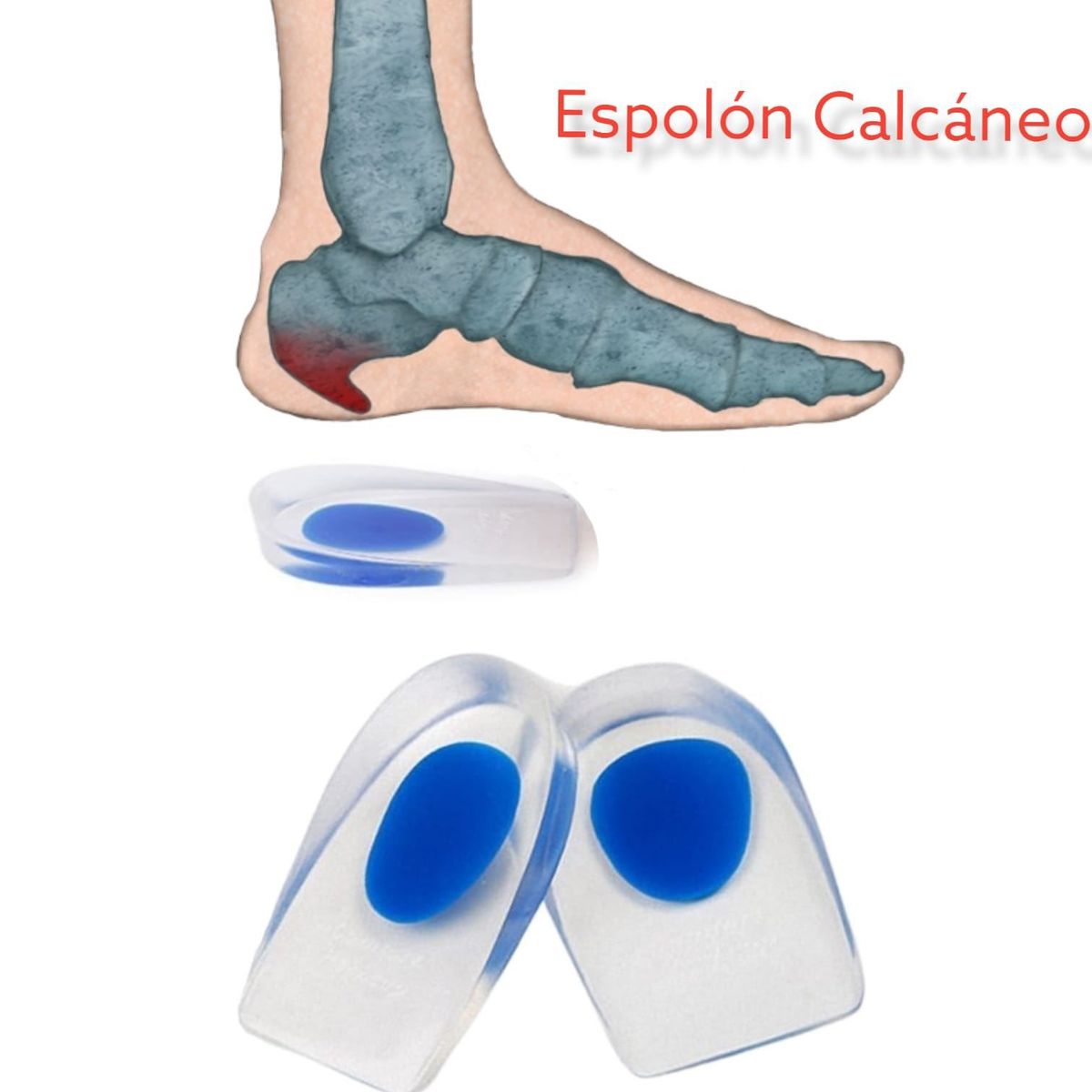 OEM - Talonera Plantilla De SIlicona Gel Flexible Para Espolon Calcaneo