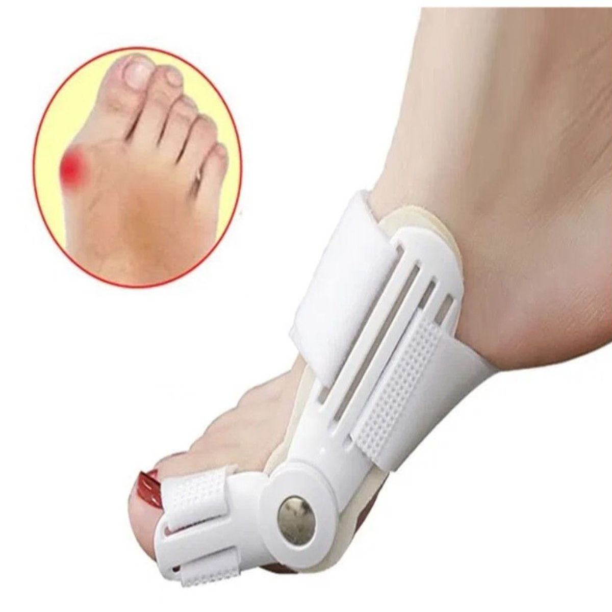 GENERICO - Corrector De Juanete Hallux Férula Endereza y Alivia el Pie