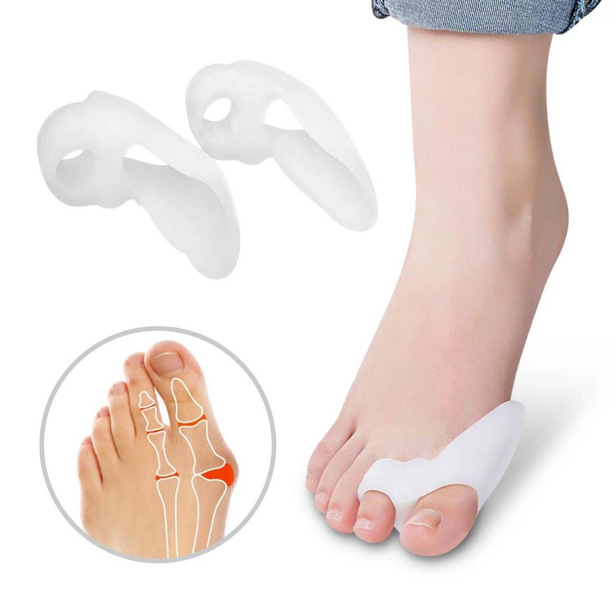 GENERICO - Corrector Progesivo Para Juanete Dedo Pie Hallux Valgus de Silicona