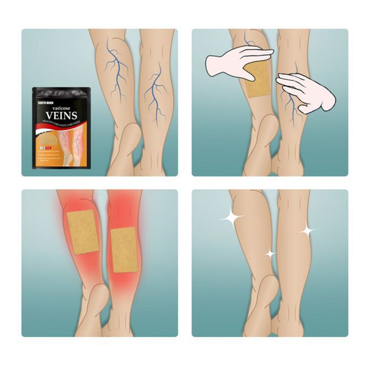 KAST PE - PACK 24 unidades - Parches Dolor Para Varices Venas Hinchadas