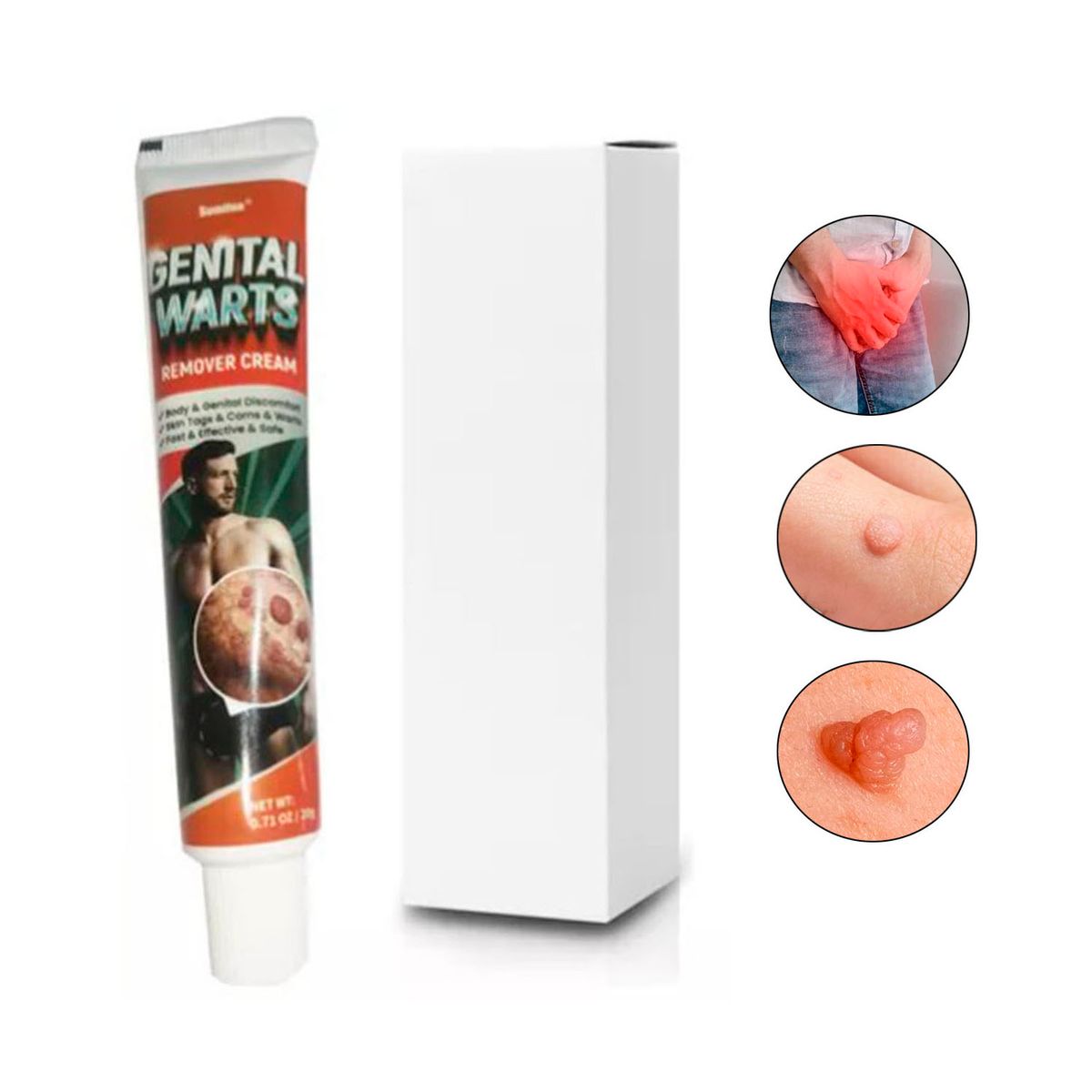 GENERICO - Elimina Verrugas Vph, Verrugas Genitales, acrocordones 15 GR