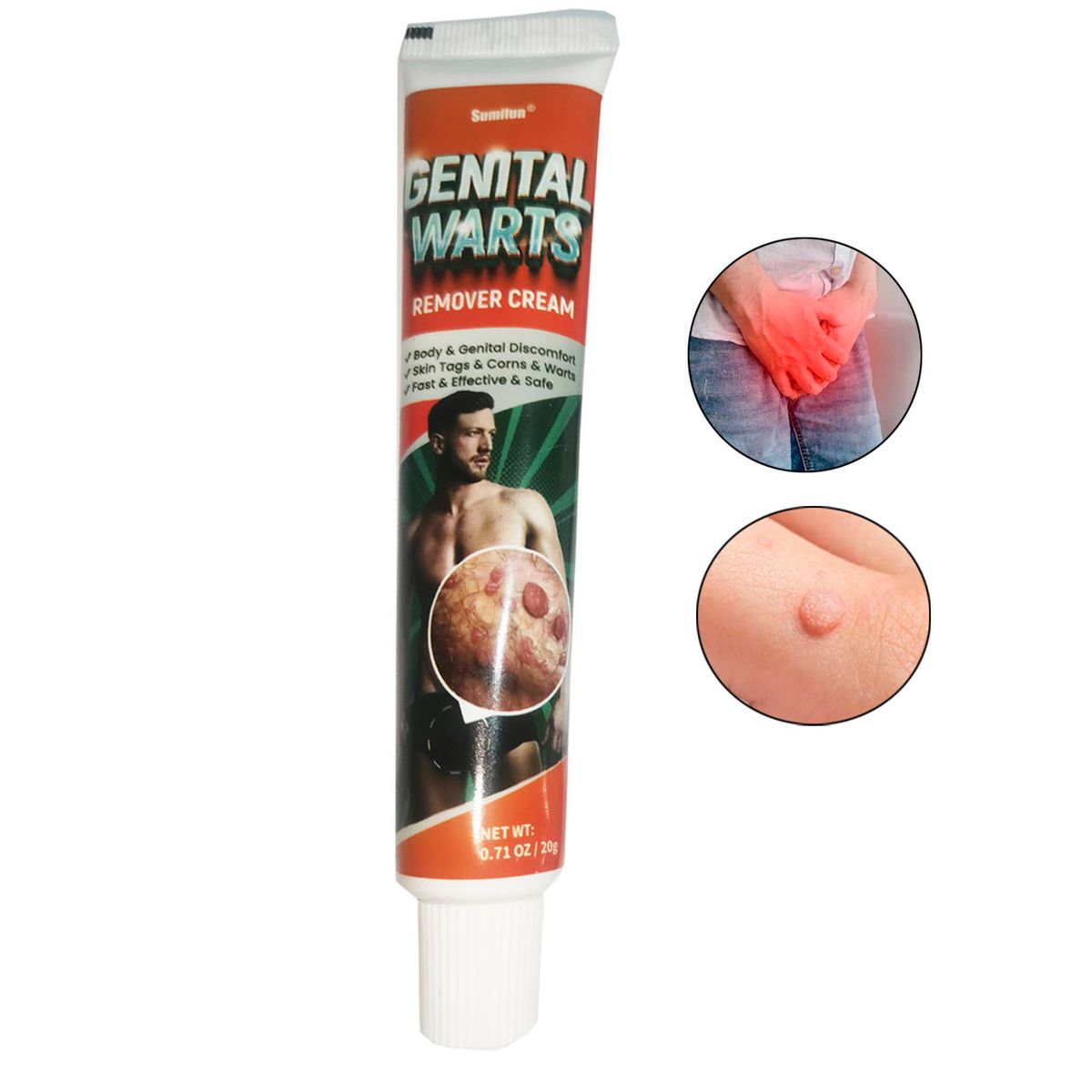 GENERICO - Elimina Verrugas Vph, Verrugas Genitales, acrocordones 15 GR