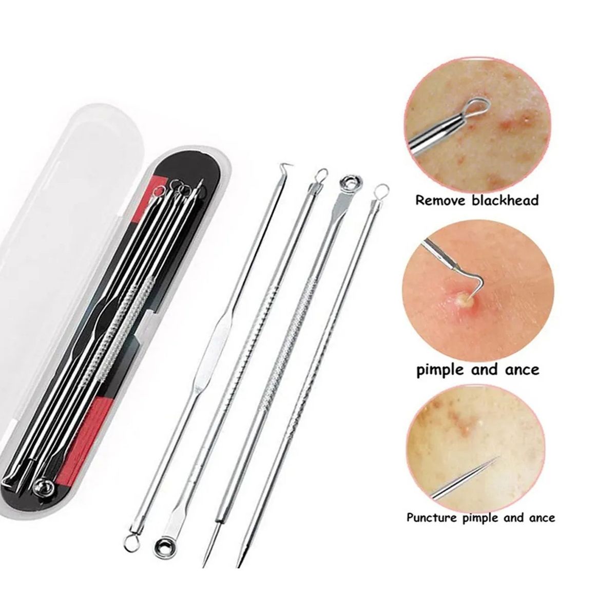 GENERICO - Removedor De Espinilla y Acné Original De Acero Inoxidable