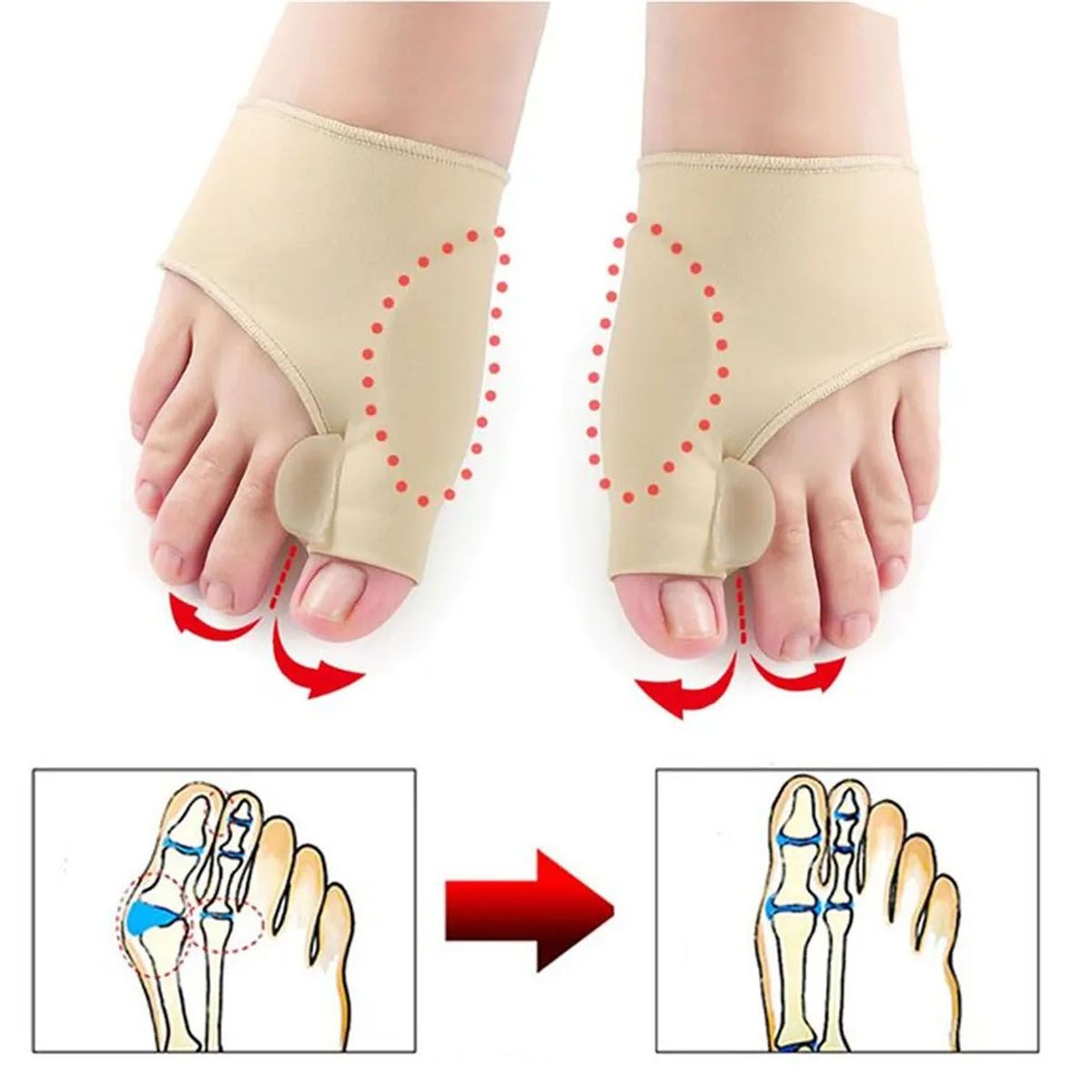 GENERICO - Corrector De Juanetes, Vendaje Ortopédico, 2 pares