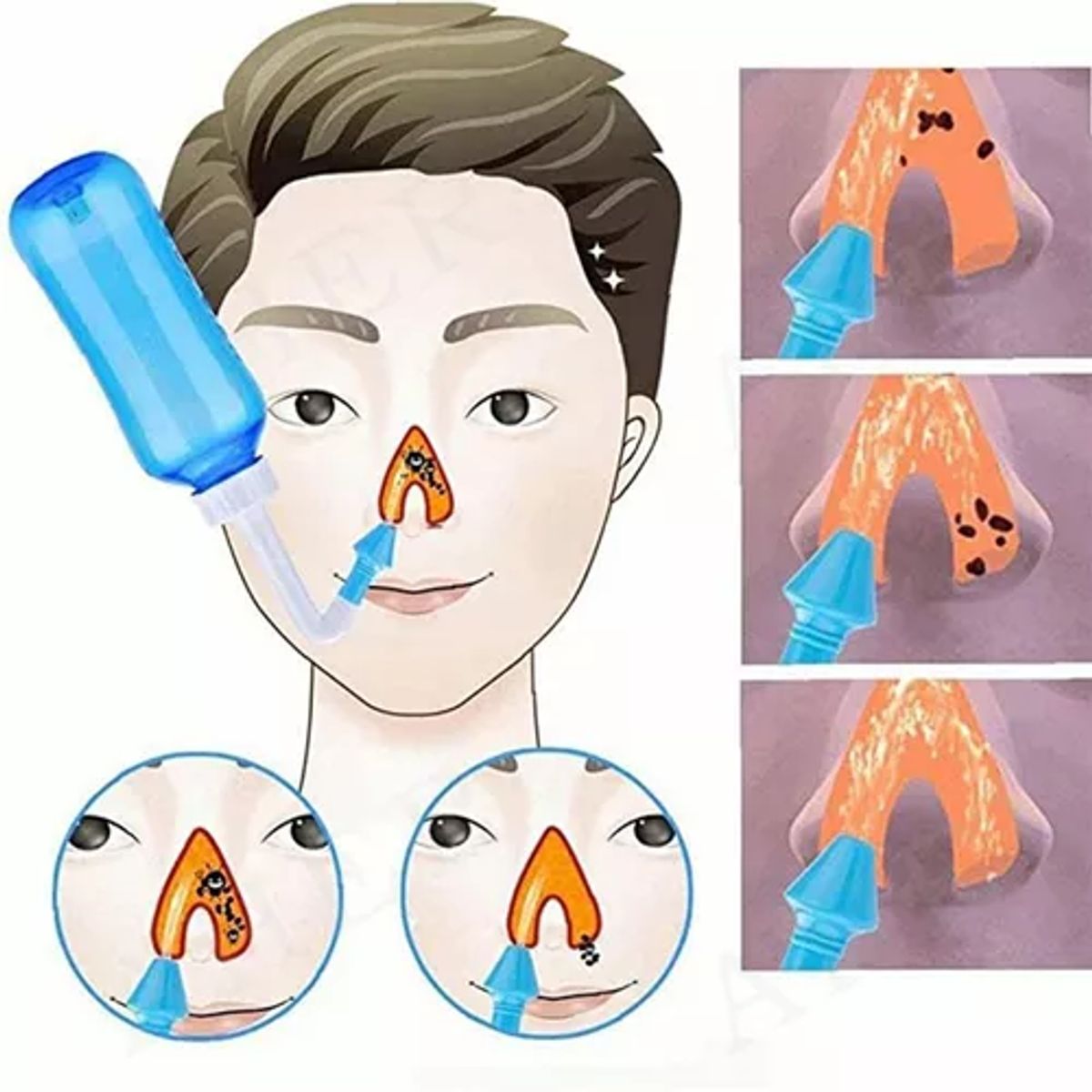 42AROZINA - Limpiador Nasales 300ml Lavado Nasal Rinitis Sinusitis