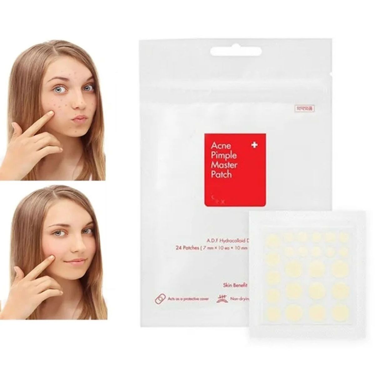 GENERICO - Parches tratamiento de Acné y espinillas COSRX