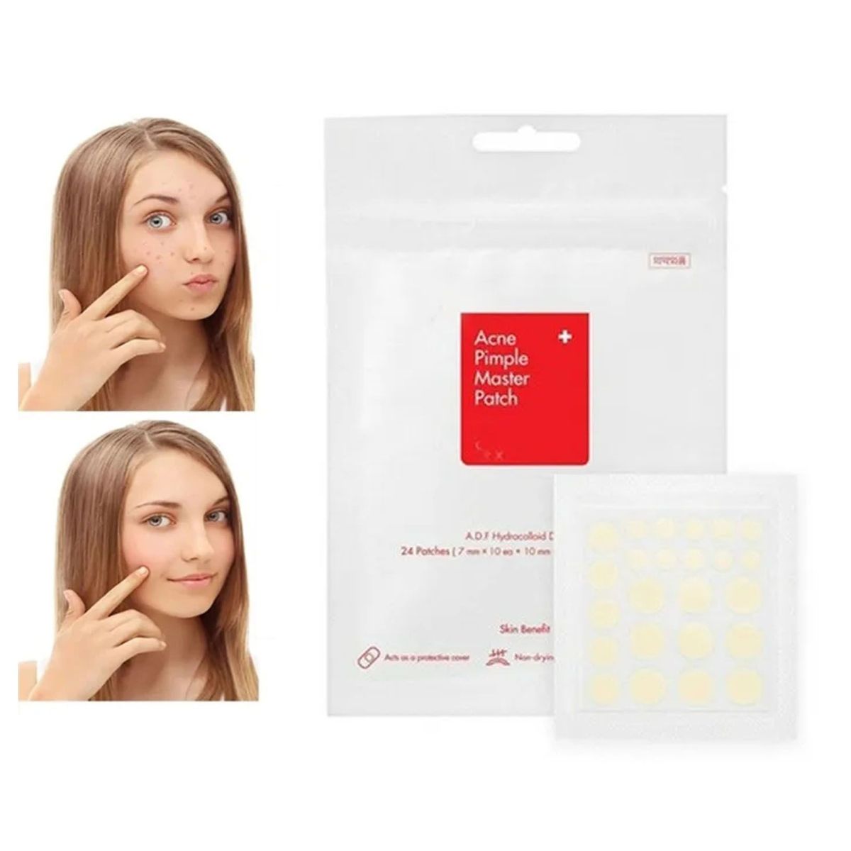 GENERICO - Parches tratamiento de Acné y espinillas COSRX