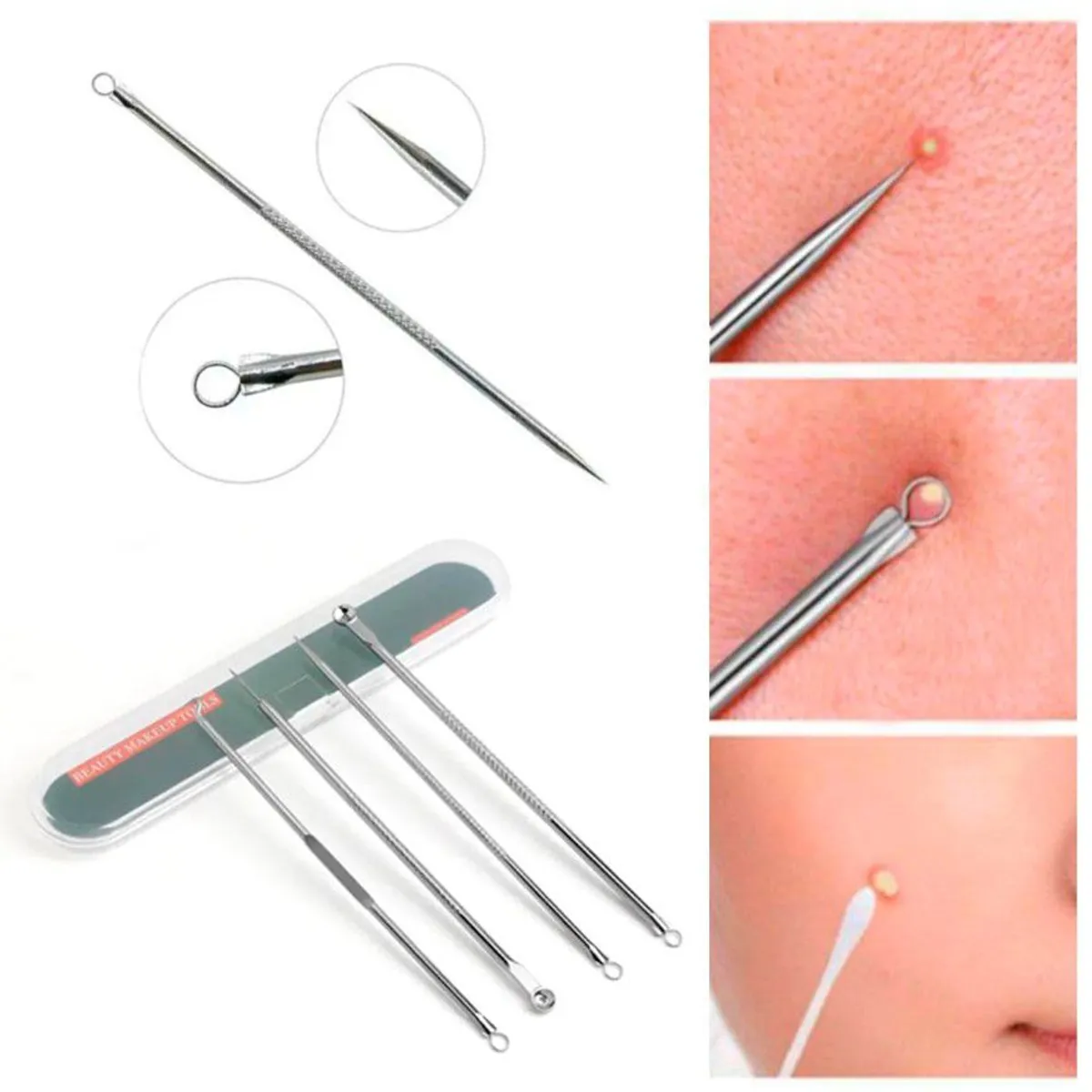 GENERICO - Pack Removedor de Espinillas y Puntos Negros