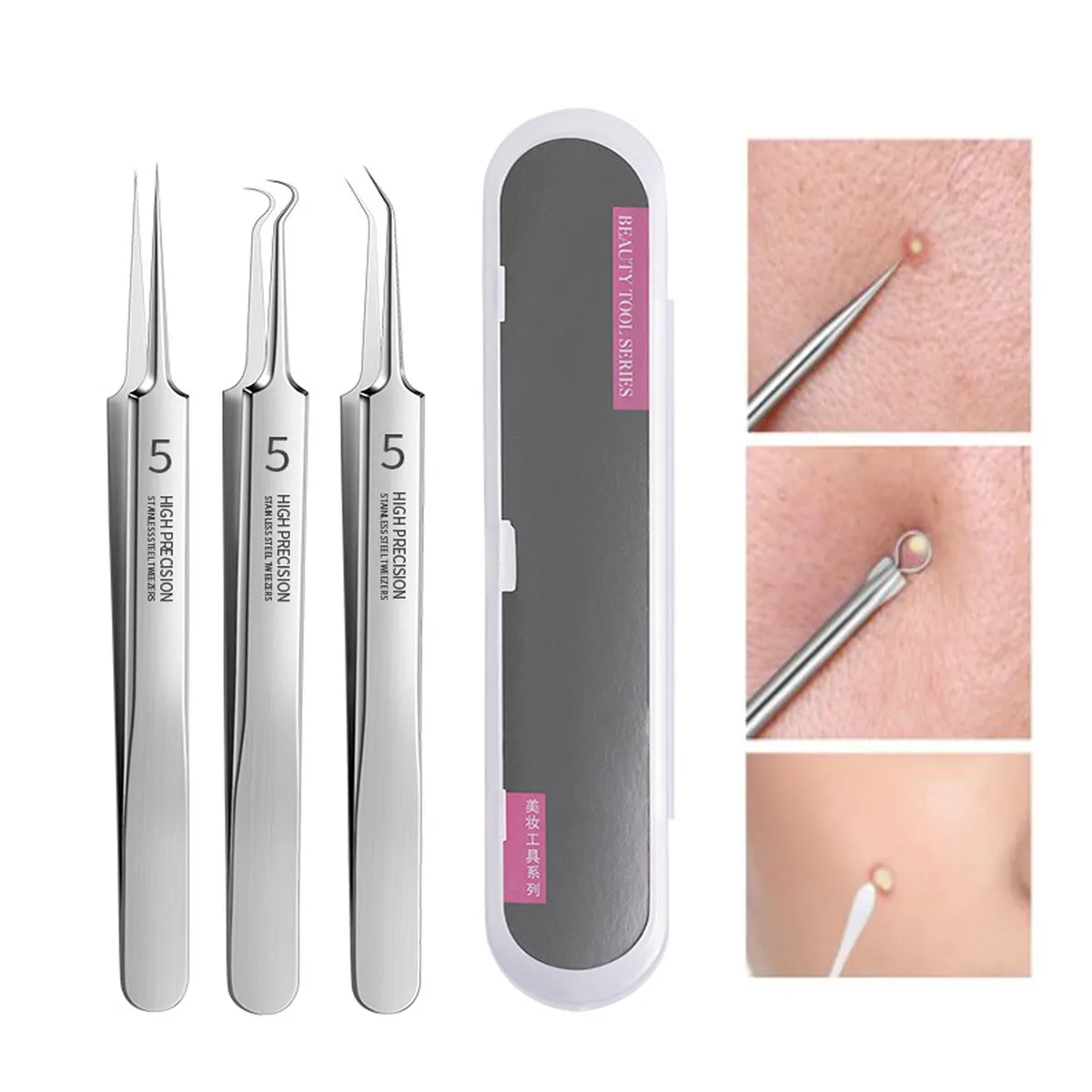 GENERICO - Pinzas profesionales ultrafinas para espinillas calidad A1