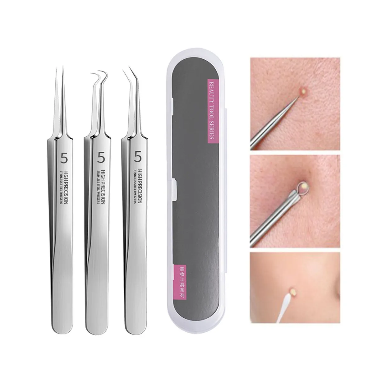 GENERICO - Pinzas profesionales ultrafinas para espinillas calidad A1