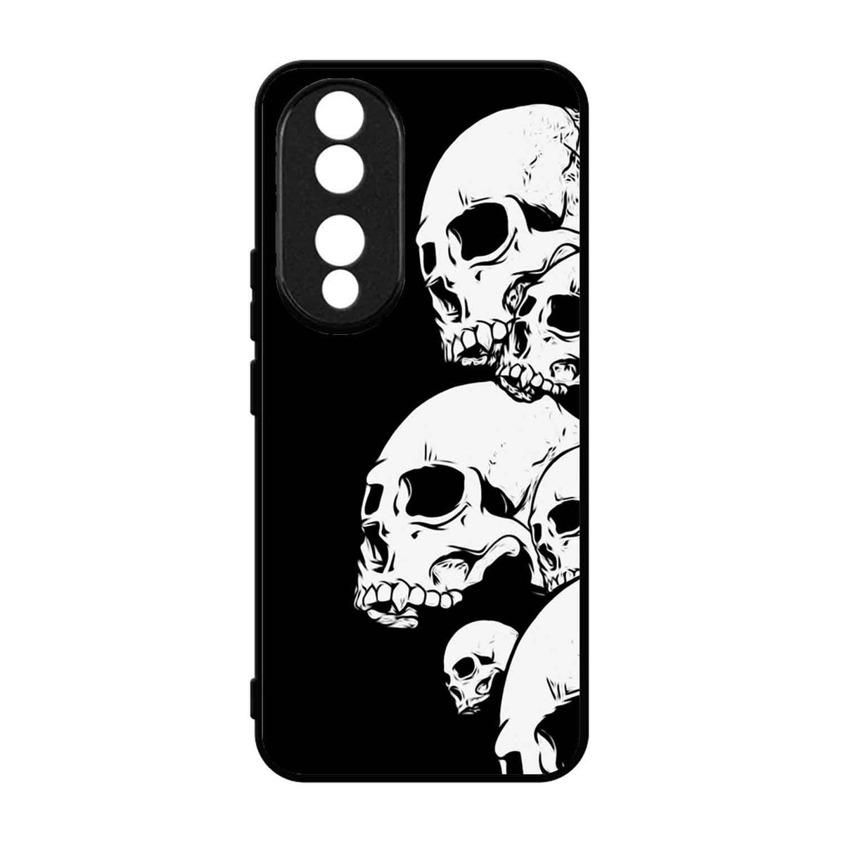 GENERICO - Funda Protector Case Para HONOR 90