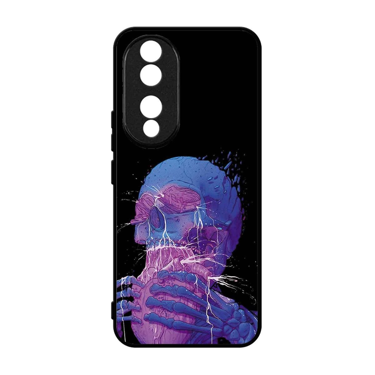 GENERICO - Funda Protector Case Para HONOR 90