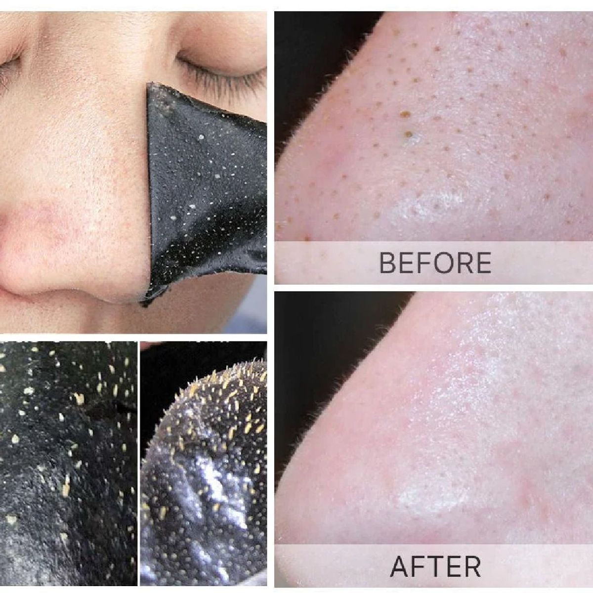 GENERICO - Tiras Nasales Limpieza De Poros Espinillas Puntos Negros