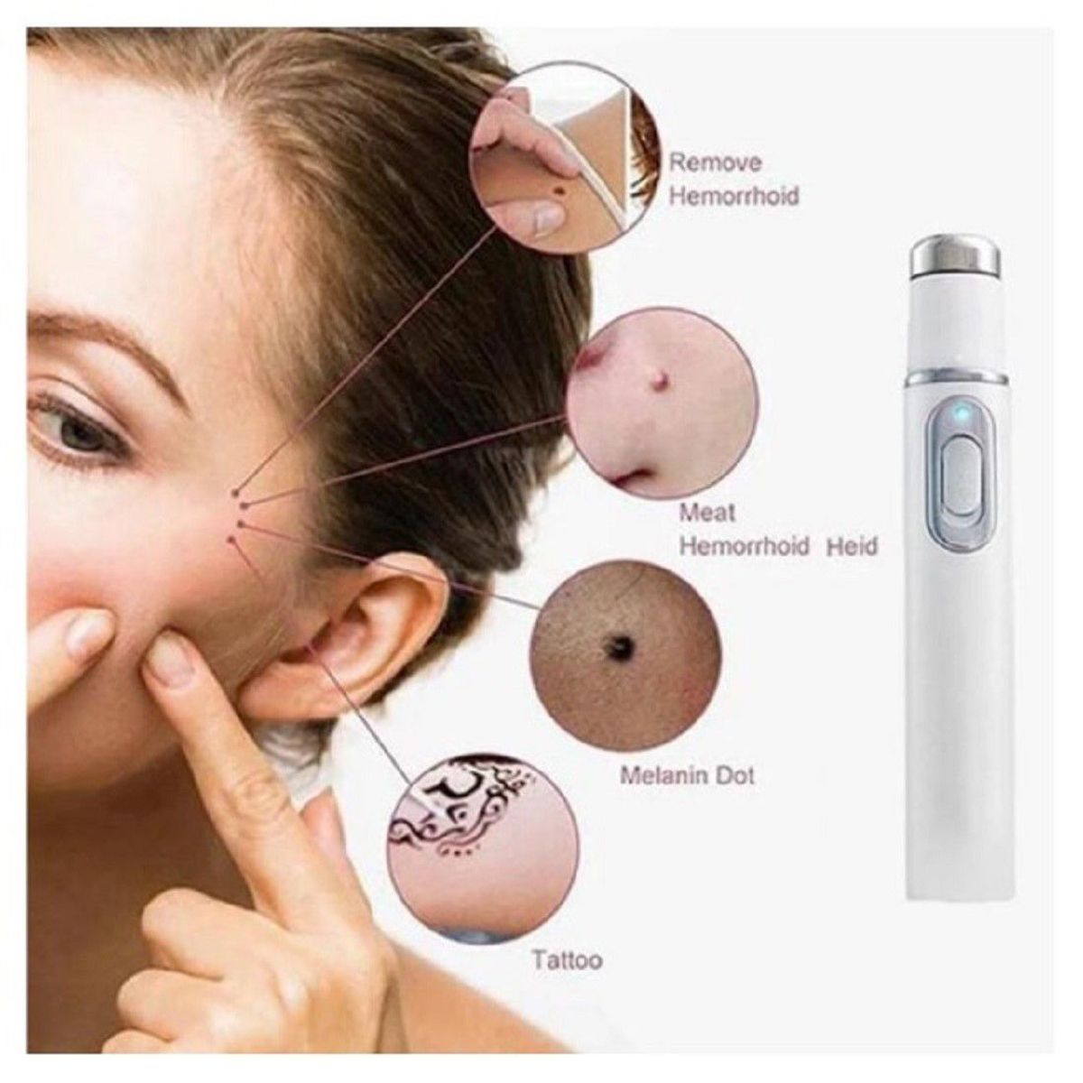 GENERICO - Laser Lápiz Luz Azul Hot Tonificador Acné Marcas de Acné Piel Genieka