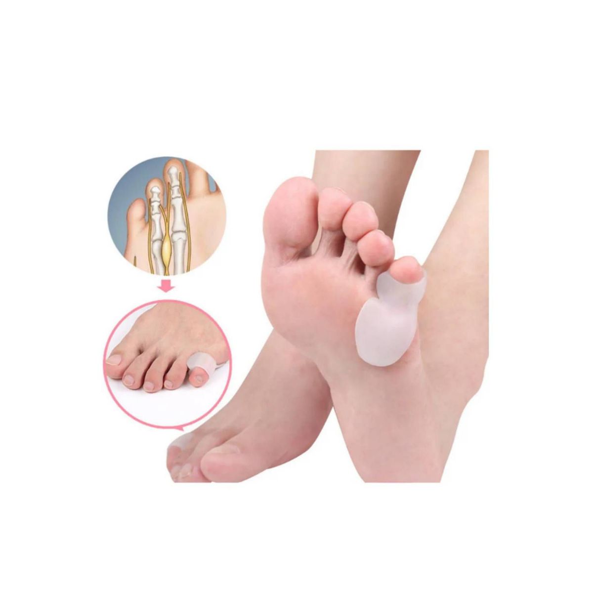 GENERICO - Corrector Separador de Dedo Pequeño Ortopédico de Silicona para Pies