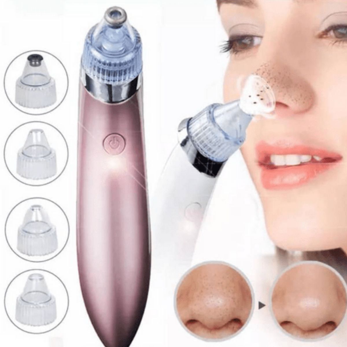 GENERICO - Removedor Succionador de Puntos Negros y Espinillas