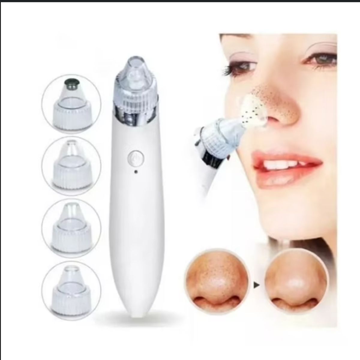 GENERICO - Removedor Succionador de Puntos Negros y Espinillas