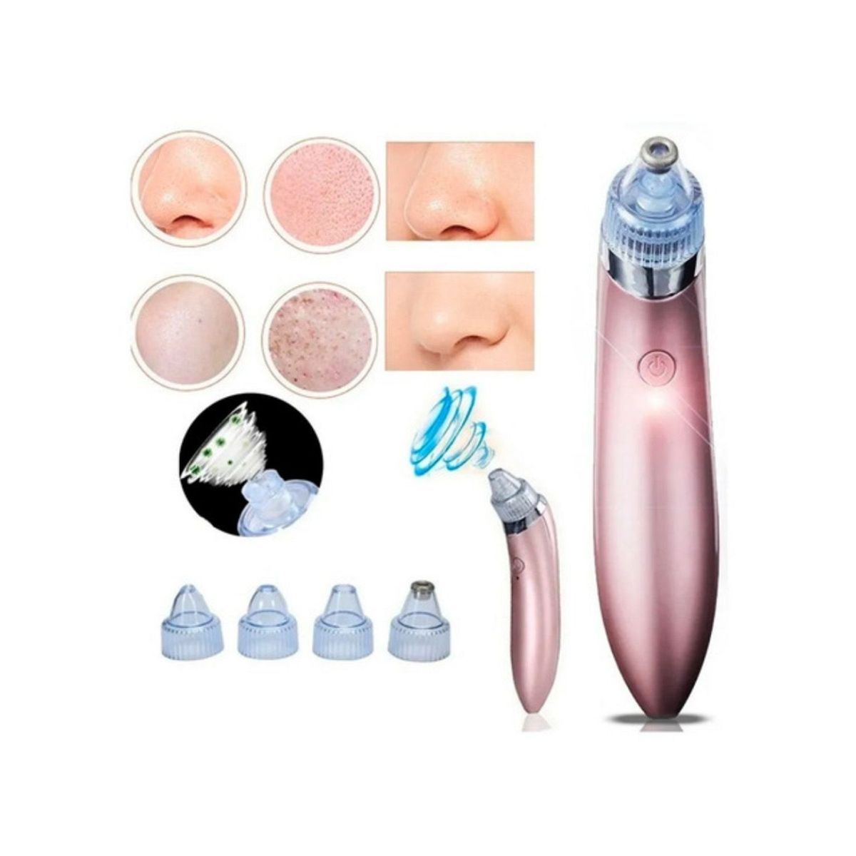 GENERICO - Limpiador de Poros Recargable 5 Niveles Succión