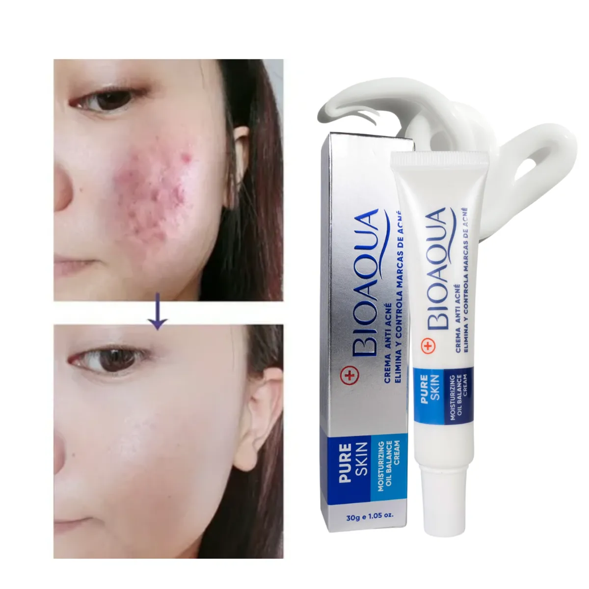 BIOAQUA - Crema Focal Pure Skin ANTIACNE BIOAQUA