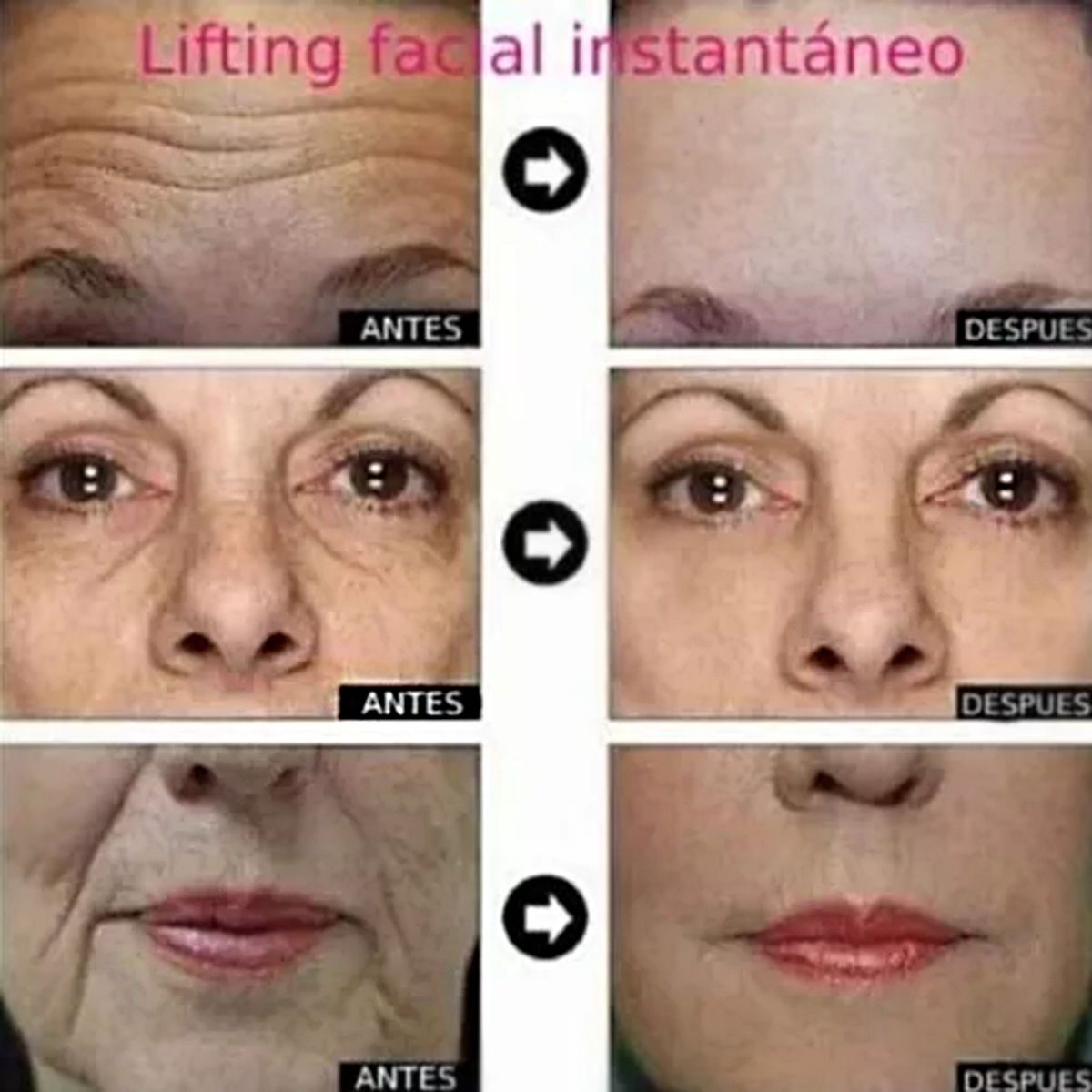 GENERICO - CintasLifting Facial Instantáneo Bandas Adhesivas 40 pzas