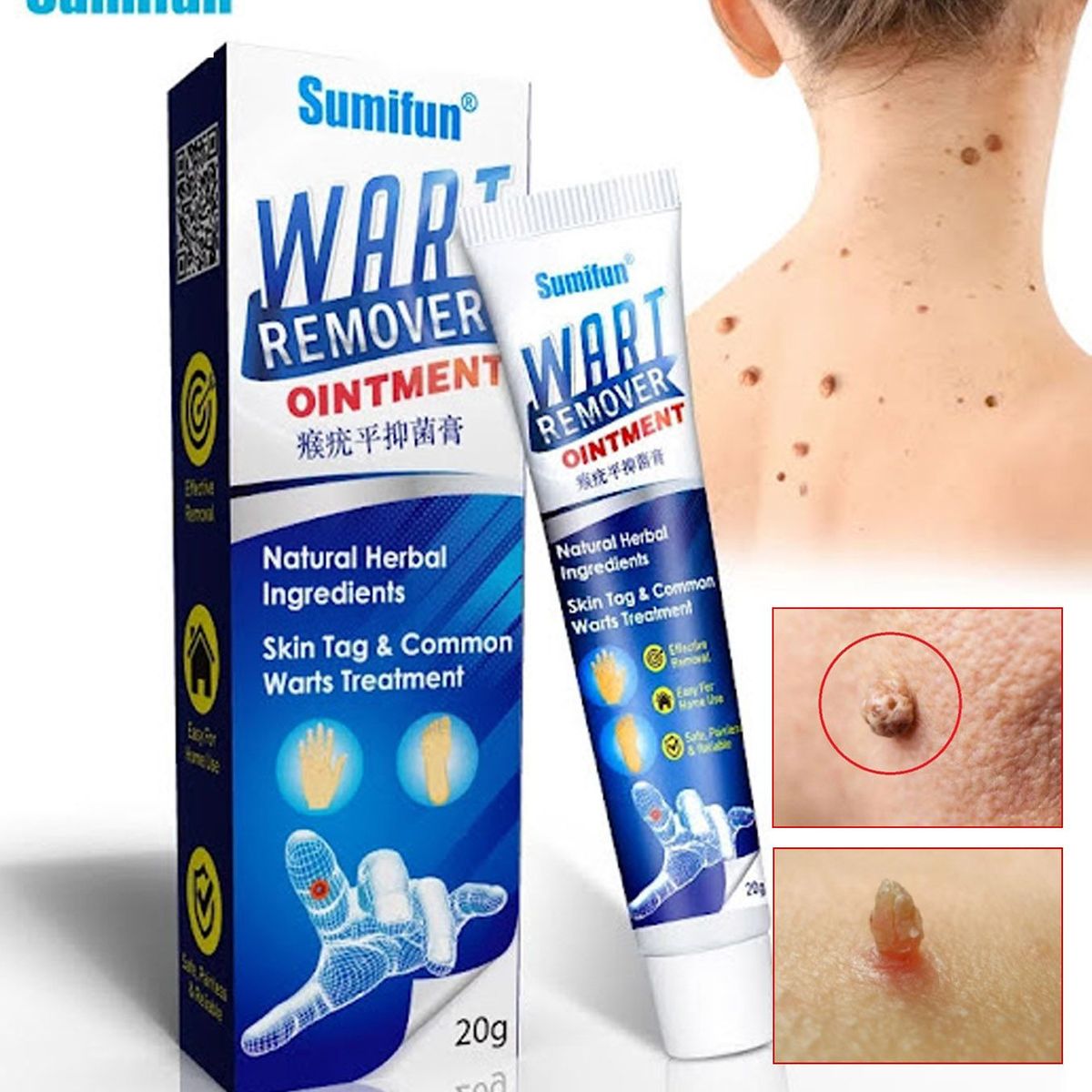 GENERICO - Crema removedora de verrugas VPH