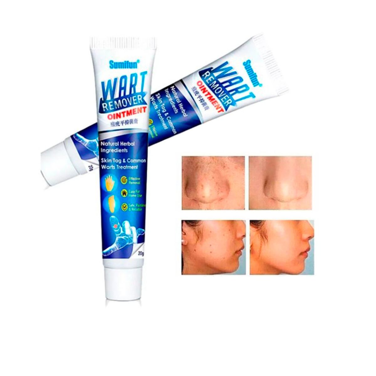 GENERICO - Crema removedora de verrugas VPH