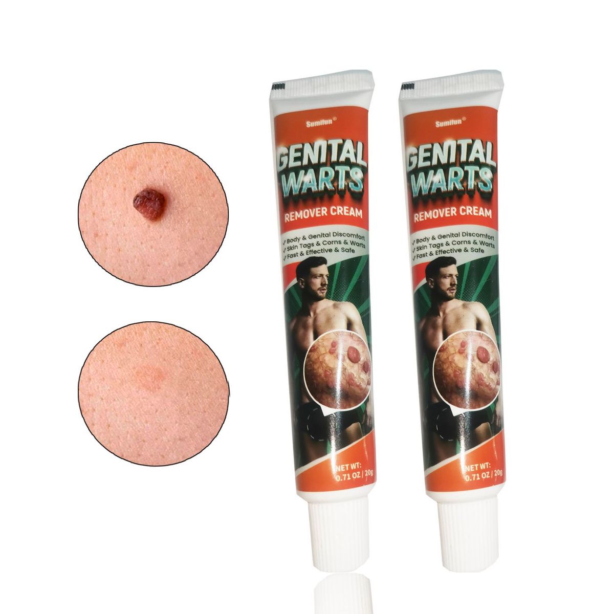 GENERICO - Crema removedora de verrugas VPH 2 und