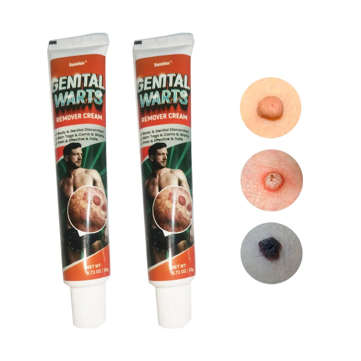 GENERICO - Crema Removedora De Verrugas Genital 20G - Rápida Y Efectiva