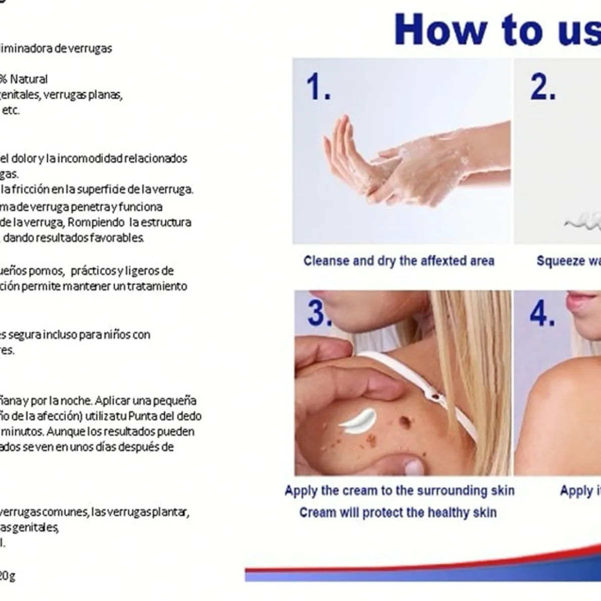 GENERICO - Crema Removedora De Verrugas Genital 20G - Rápida Y Efectiva