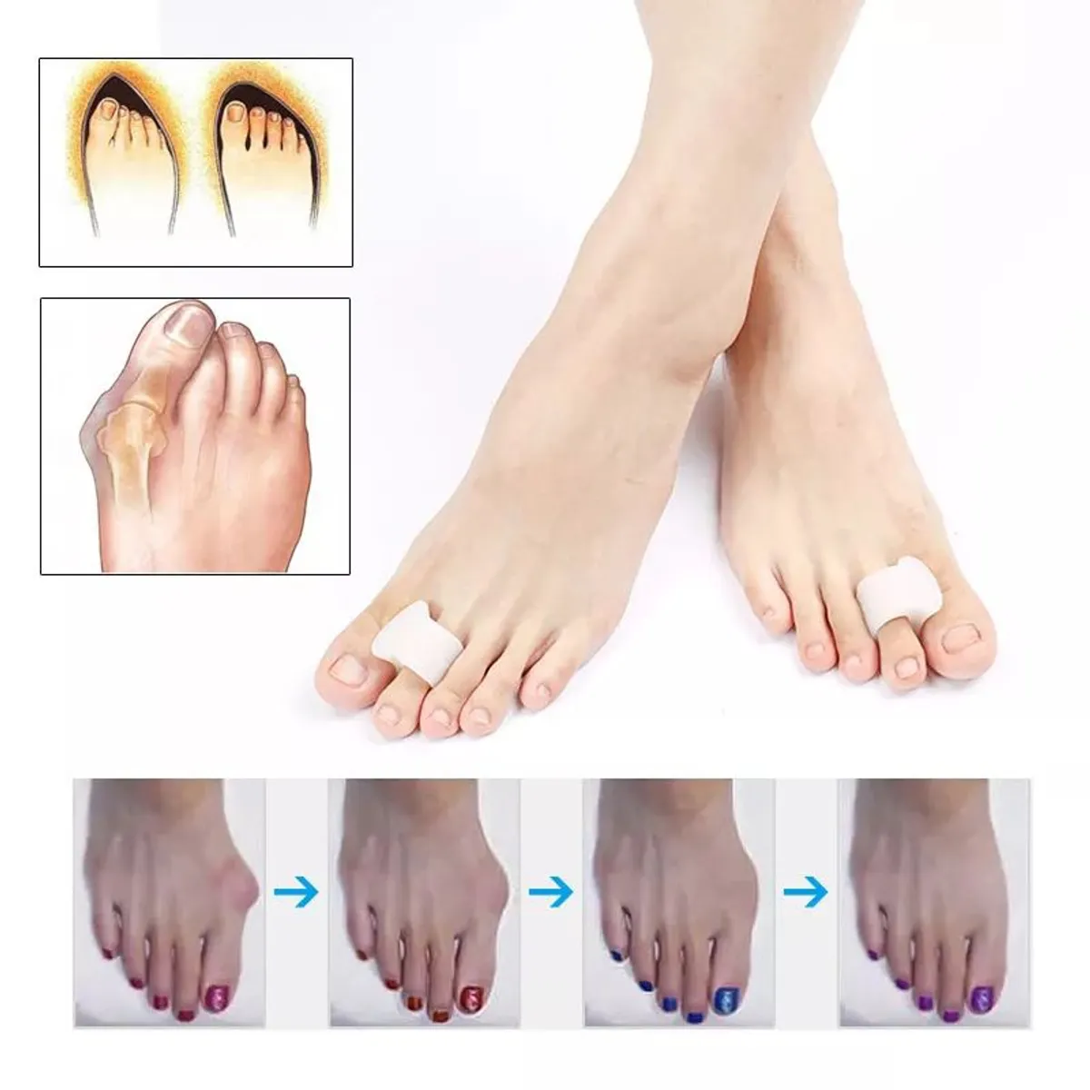 GENERICO - Separador de dedos, Corrector De dedos , 1 Par