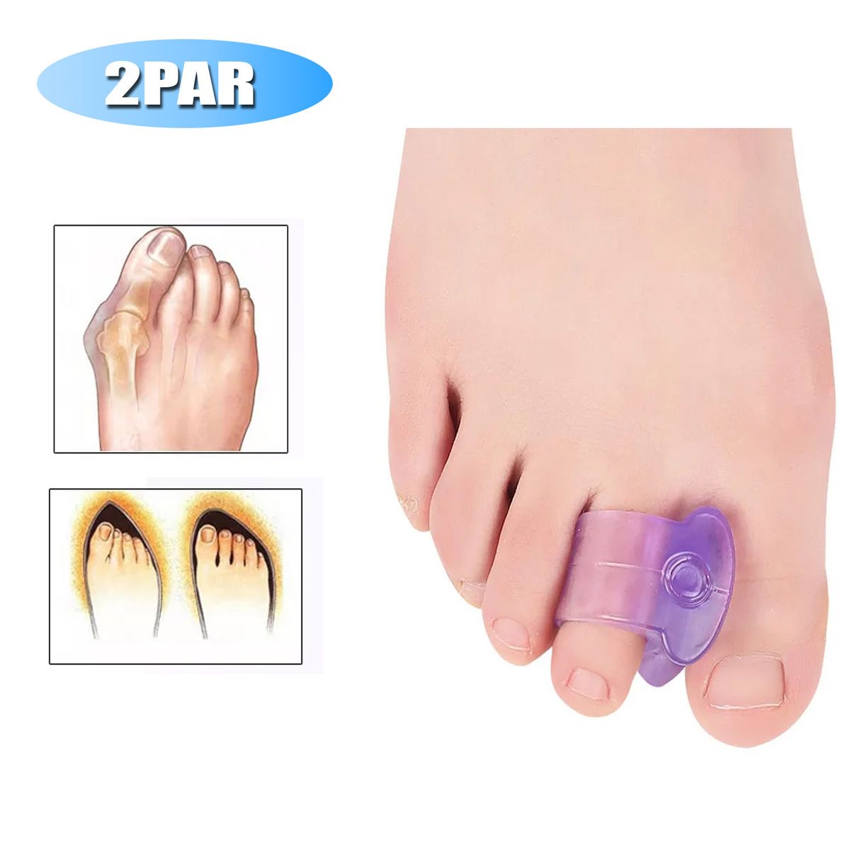 GENERICO - Separador de dedos, Corrector De dedos, ortopédico 2 Par