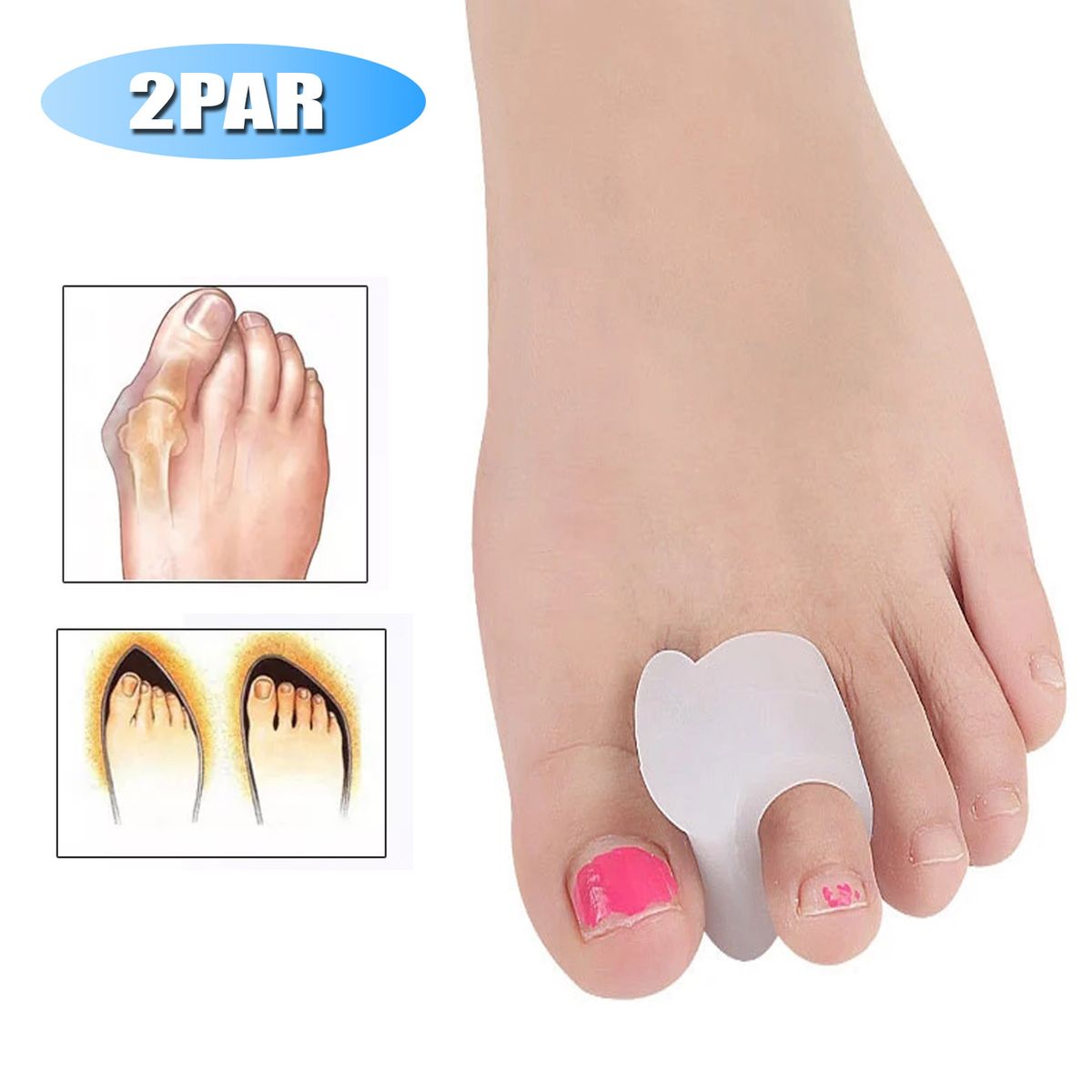 GENERICO - Separador de dedos, Corrector De dedos, ortopédico 2 Par