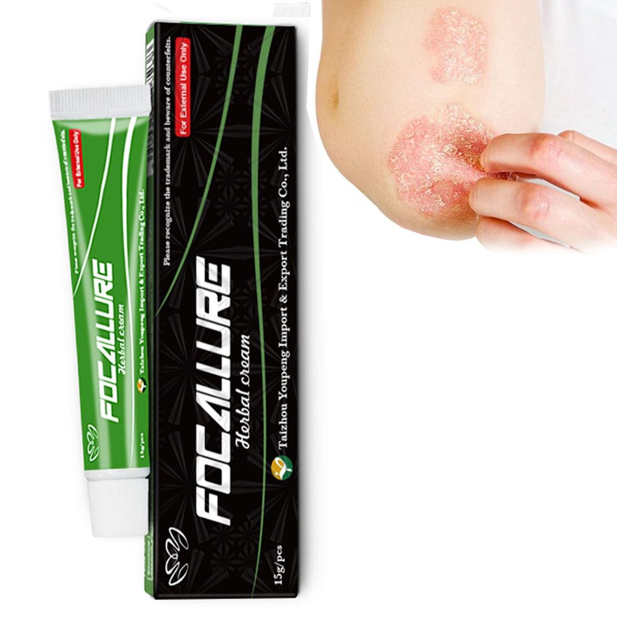 GENERICO - Crema para soriasis Y Dermatitis