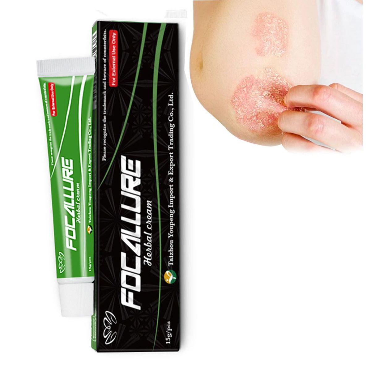 GENERICO - Crema para soriasis Y Dermatitis