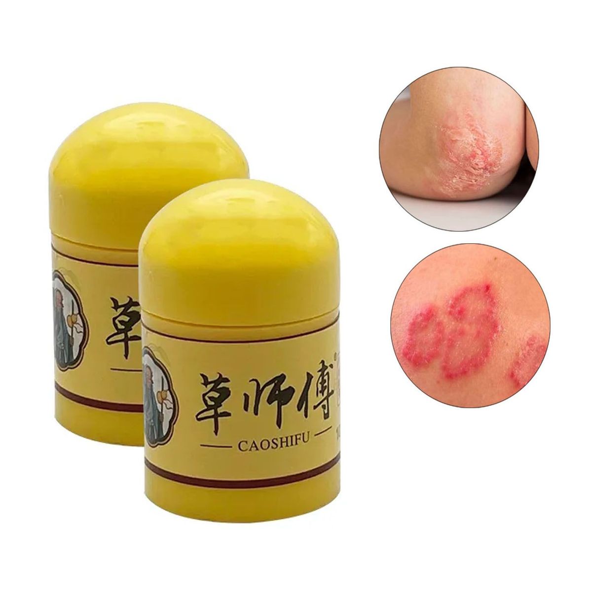 GENERICO - Pomada para soriasis Dermatitis eccemas 10gr