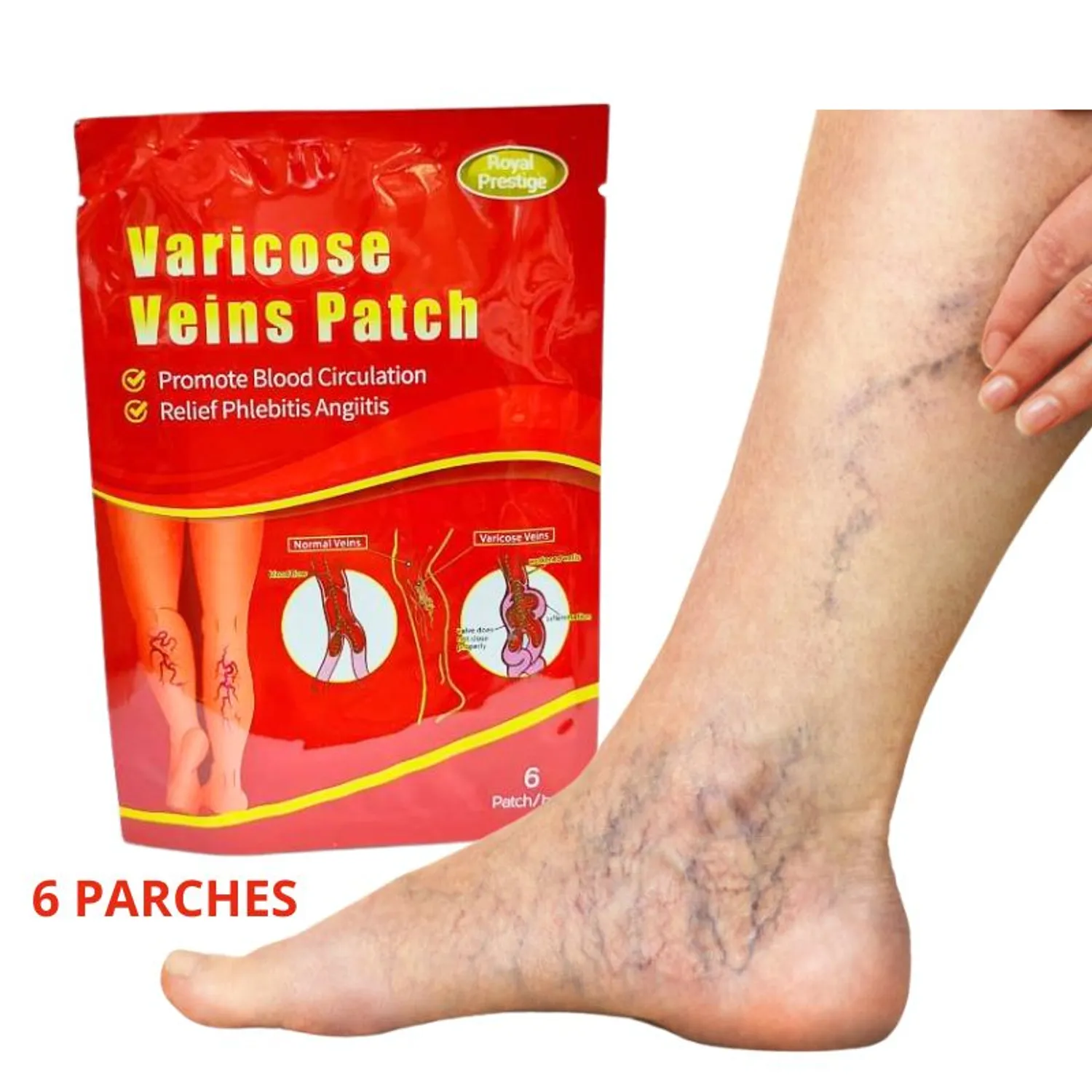 Parches para varices GENERICO | falabella.com